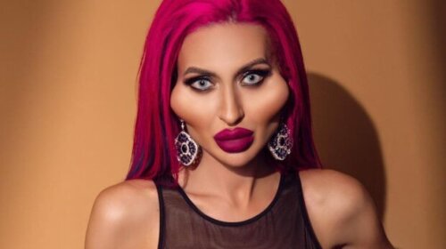 "Еще больше будет дырка между ног": Настя Покрещук с отеками и жуткими синяками вышла на связь с фанатами