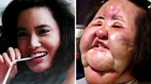 ТОП-11 знаменитостей, які понівечили своє обличчя пластикою: ФОТО до і після