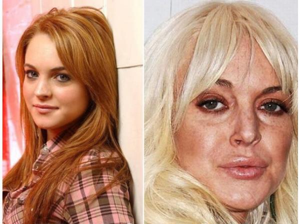 Подраздел 1: Искусственно увеличенные губы